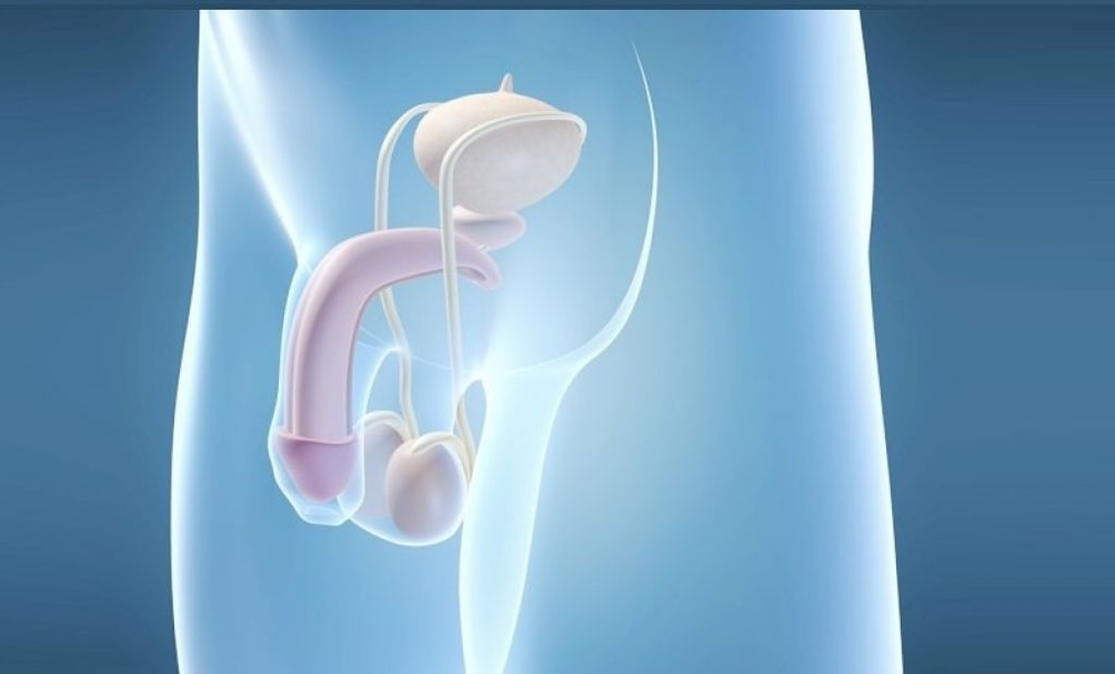 Implantation of the prosthesis is a surgical method of enlarging the male penis